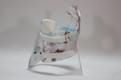 scoliosis brace Gensingen, Advanced Orthodynamics